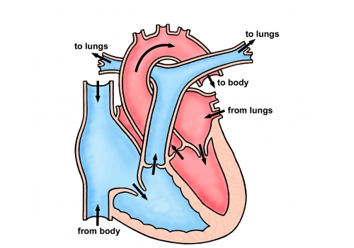 bicuspid aortic stenosis