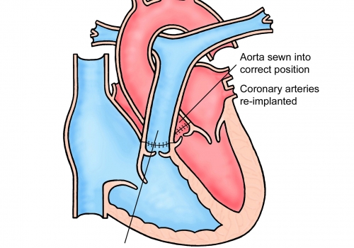 Hanging your heart as 2025 they gasp from their arteries